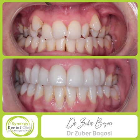 Cosmetic Makeover Case 5 Cosmetic Makeover Case 5