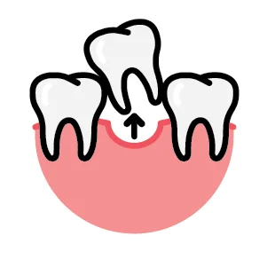 Synergy Dental Extraction