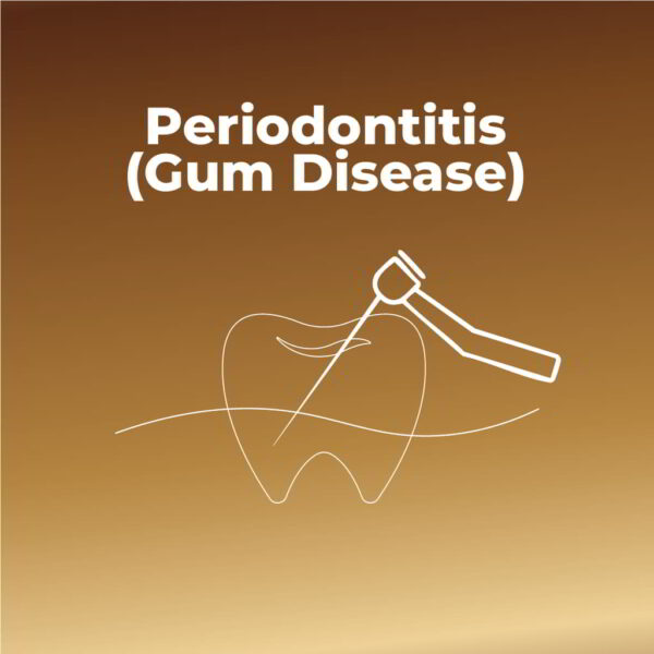 Periodontitis Gum Disease