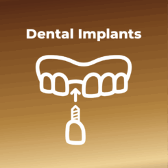 Dental Implants