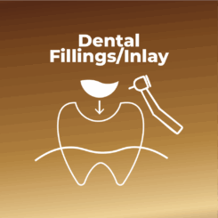 Dental Fillings and Inlays