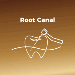 Endodontics (Root Canal)