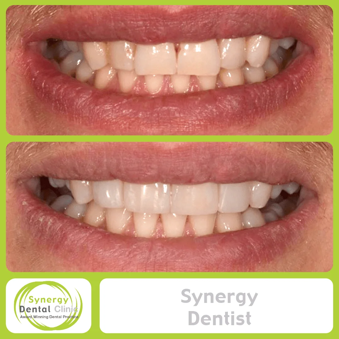 Synergy Dentist 3