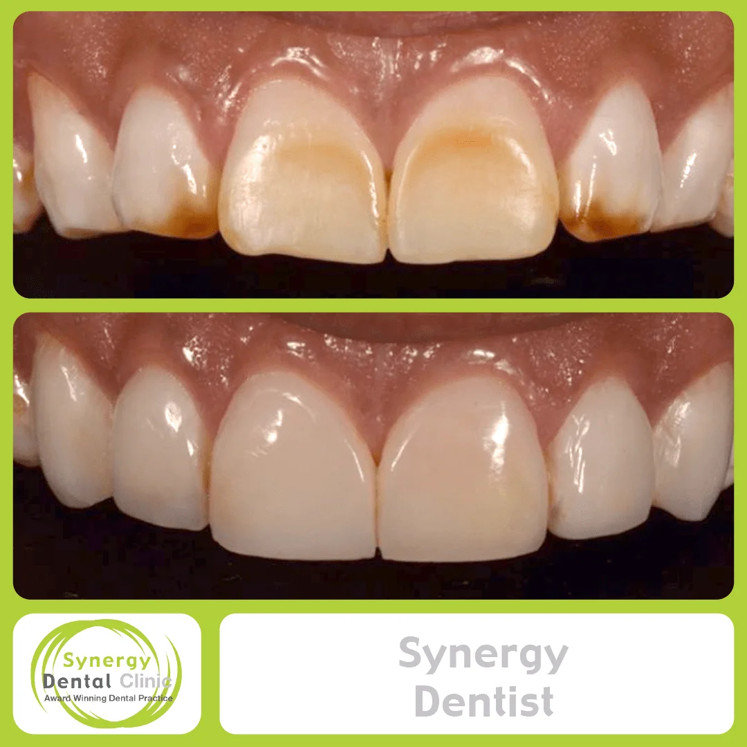 Synergy Dentist 9