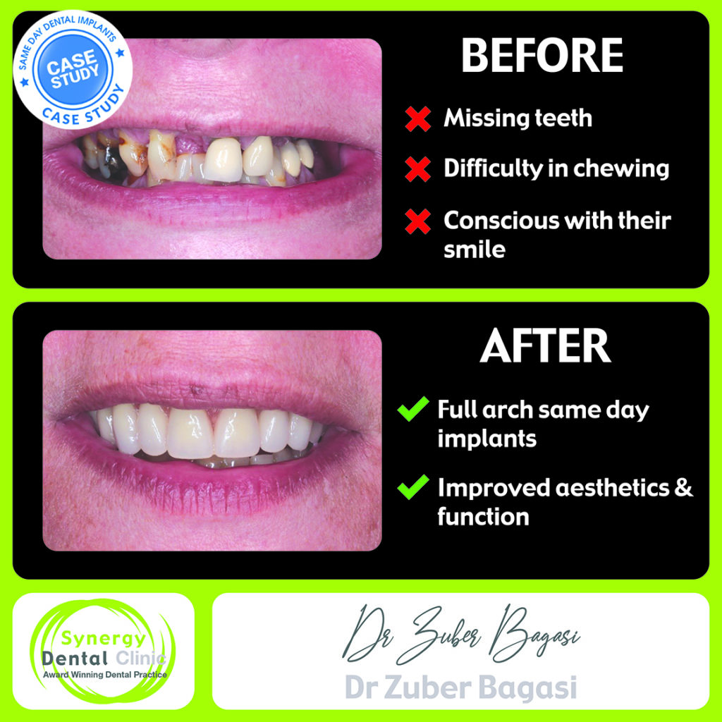 Before and After Dental Case Studies • Synergy Dental Clinics