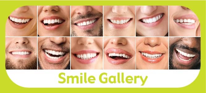 Smile gallery - dentist before and after