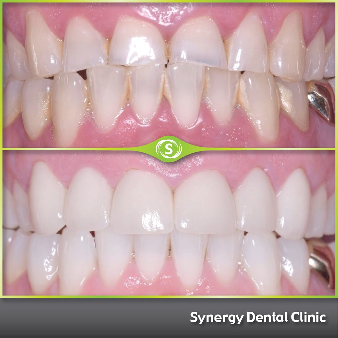 Cosmetic Dentistry 444