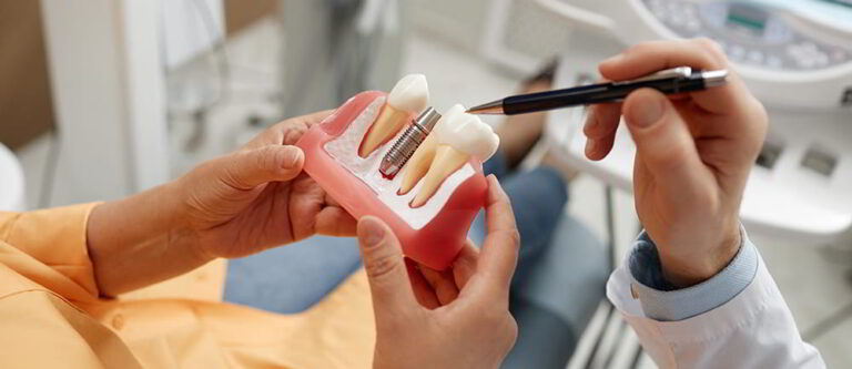 3 - Dental Implants – what to expect 5 Questions with Synergy Dental Pt.2