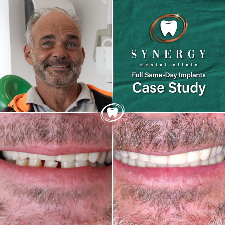 Before_and_After_Case_Study_Frame_-_FSDI_2_NL