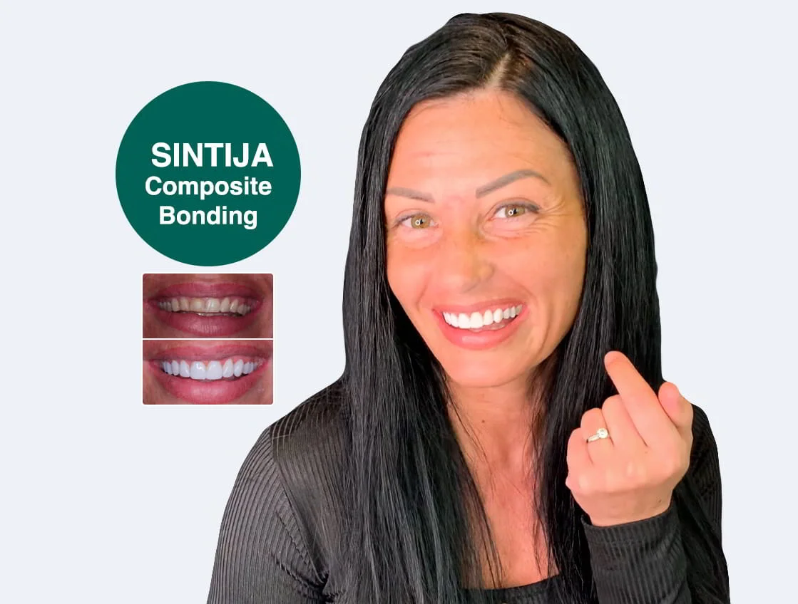 CompositeBonding-Sintija