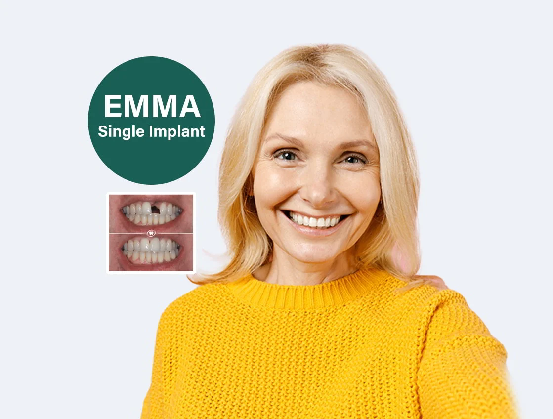 Emma-Single Dental Implant