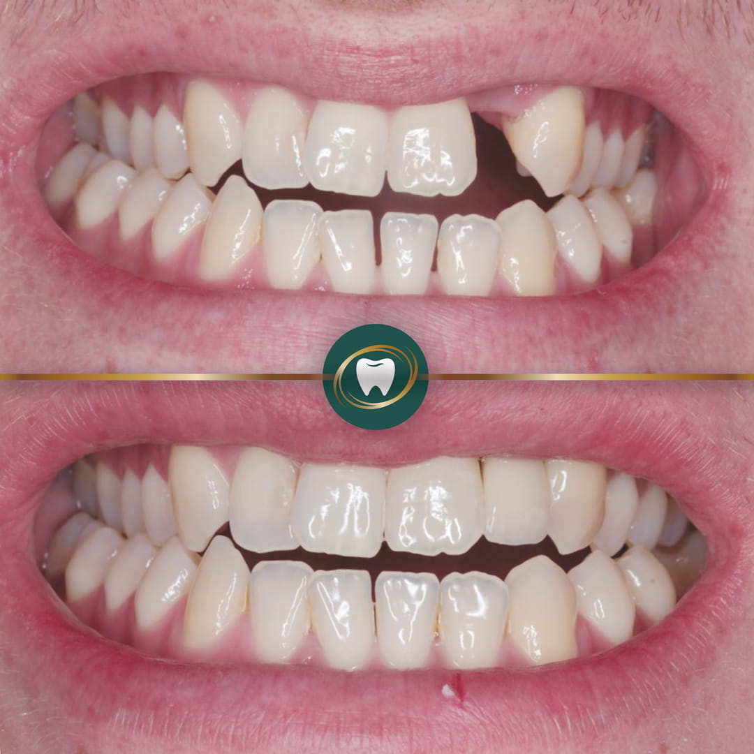 ZB. Dental Implants. D.Stirzaker.666443