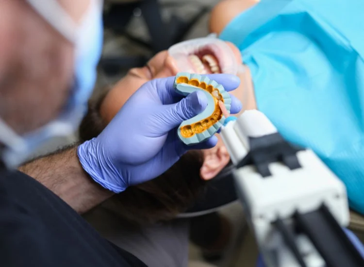 Dental Veneers Preparation - Synergy Dental Clinic