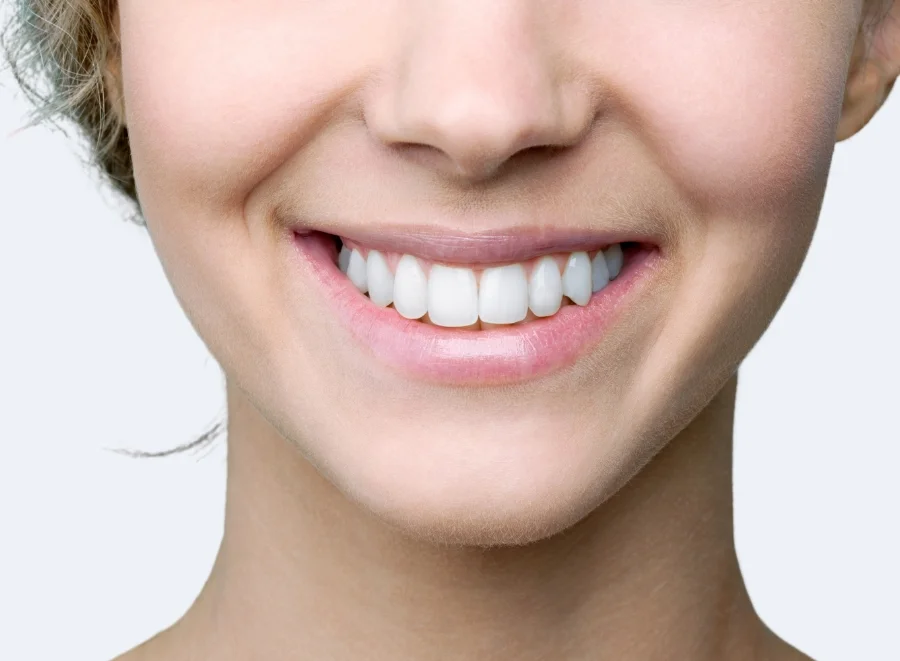Teeth whitening - Review appointment