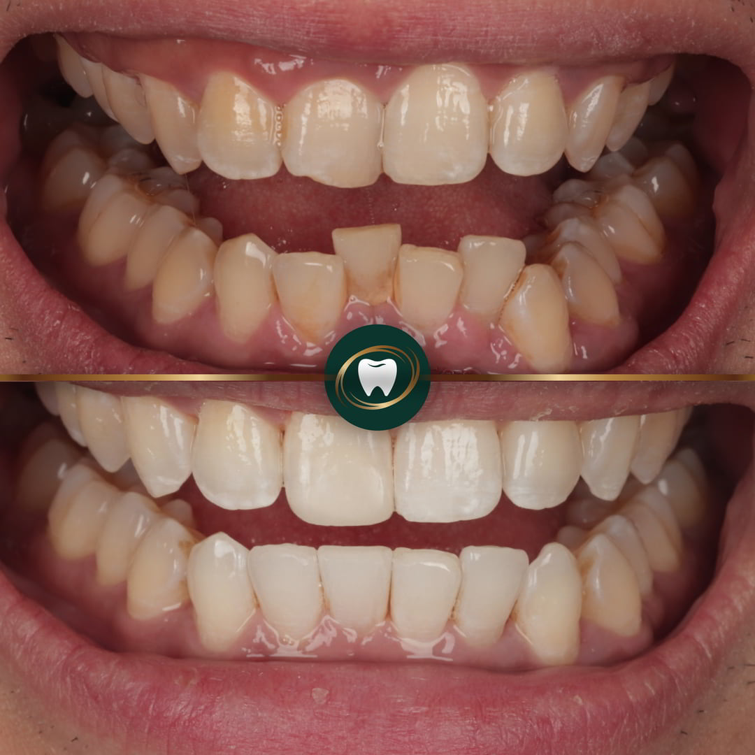 Dr. Rushaine Smith - Invisalign