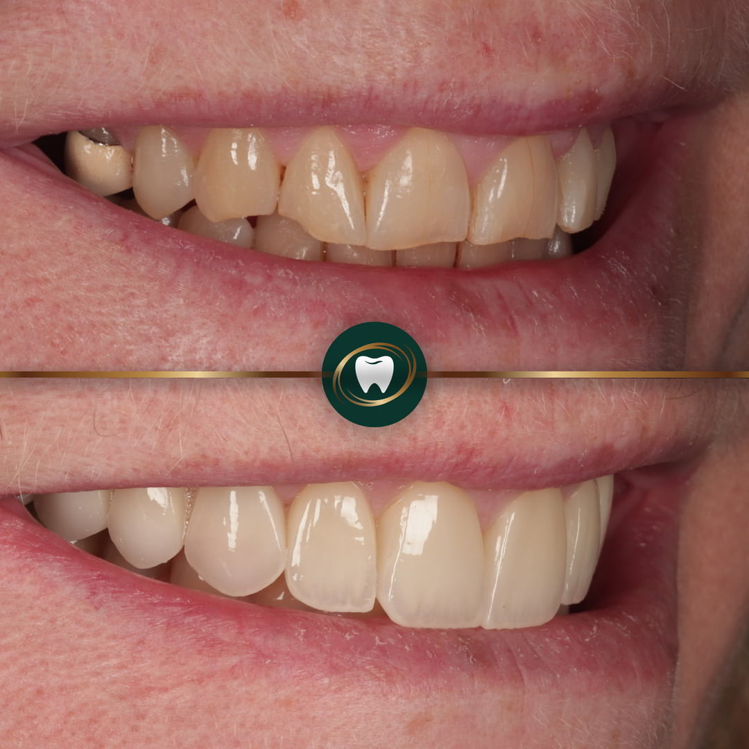 Dr. Rushaine Smith - Smile makeover