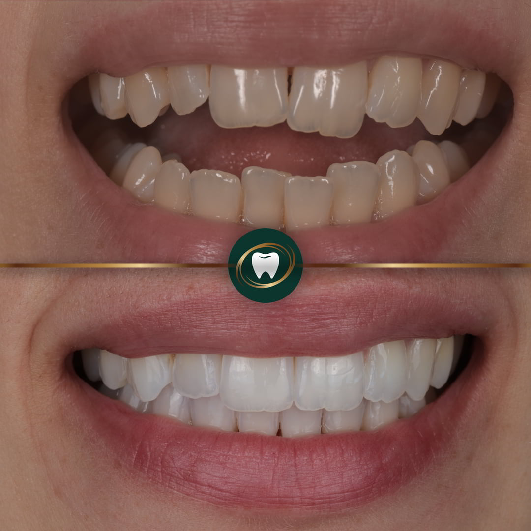 Mak Dhinsa Invisalign 2-01