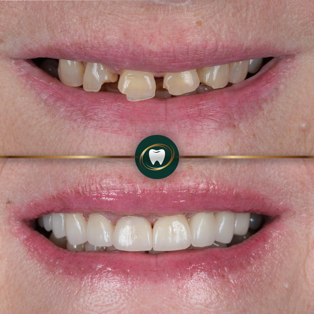 Mak Dhinsa Smile Makeover 1-01