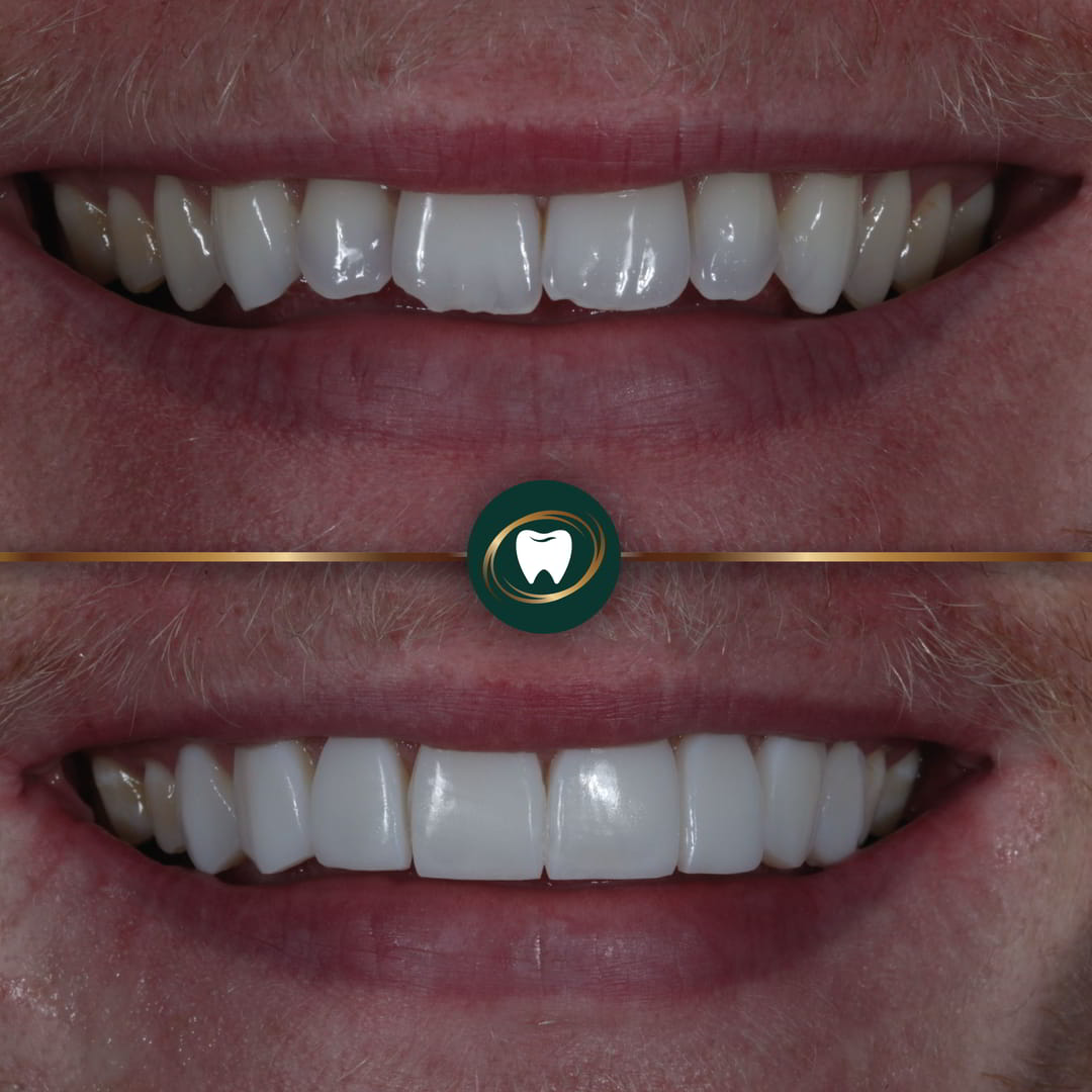 Smile Gallery Thumbnails UA997