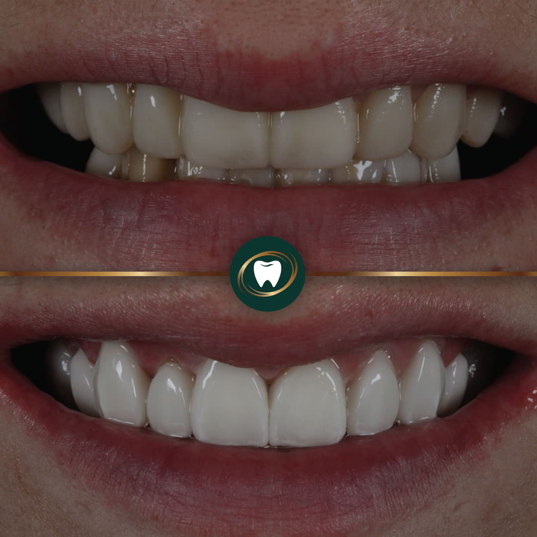 Smile Gallery3456789iu