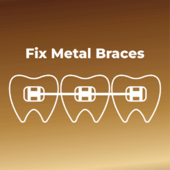 Fix Metal Braces