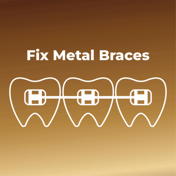 Fix Metal Braces